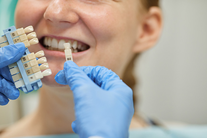 dental-implants shreveport la